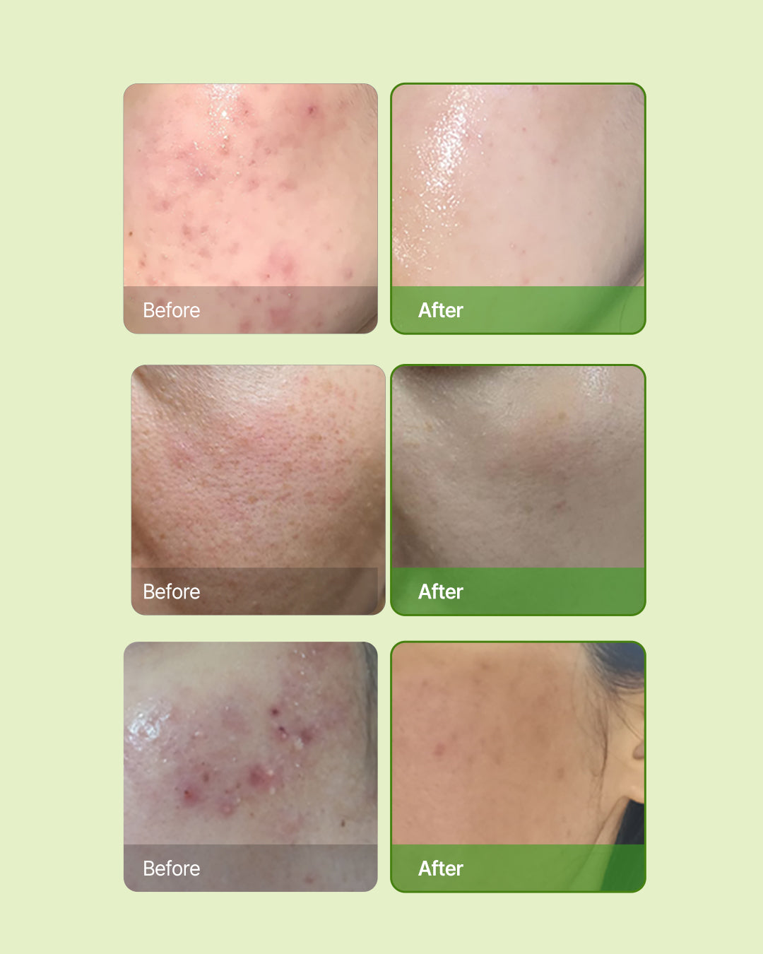 Skin Barrier Ato Cream — imagen 3